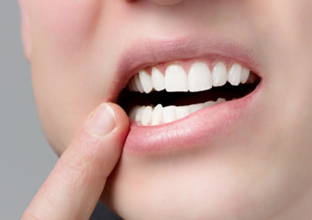歯周病は歯を失う最大の原因